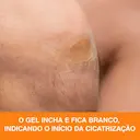Curativo 3M Nexcare Cicatrização Avançada com 6 unidades