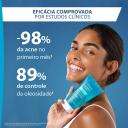 Gel de Limpeza Antiacne Keracnyl para Peles Oleosas a Acneicas 150g