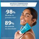 Gel de Limpeza Antiacne Keracnyl para Peles Oleosas a Acneicas 300g