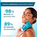 Gel de Limpeza Antiacne Keracnyl para Peles Oleosas a Acneicas 60g