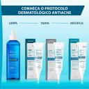 Gel de Limpeza Antiacne Keracnyl para Peles Oleosas a Acneicas 60g
