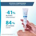 Tratamento Antiacne Keracnyl PP+ 30ml