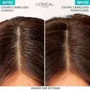 Shampoo L'Oréal Paris Elseve Pure Hialurônico 400ml