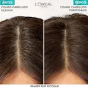 Shampoo Micelar Antioleosidade Elseve Pure Hialurônico 300ml