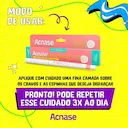 Lapiseira Secativa para Cravos e Espinhas Acnase com 0,3g