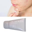 ACNOVER GEL ANTIACNE RUBY ROSE 30G